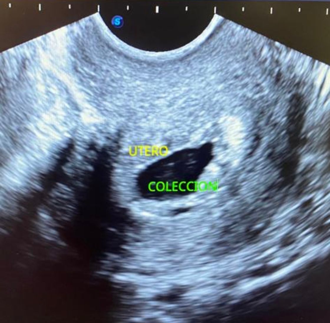 Juan José Solano Perez-4