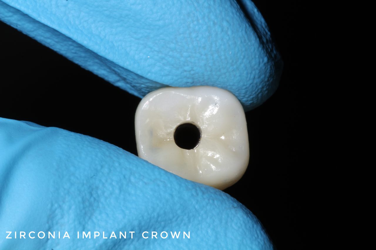 Hylse Najera Moya-16