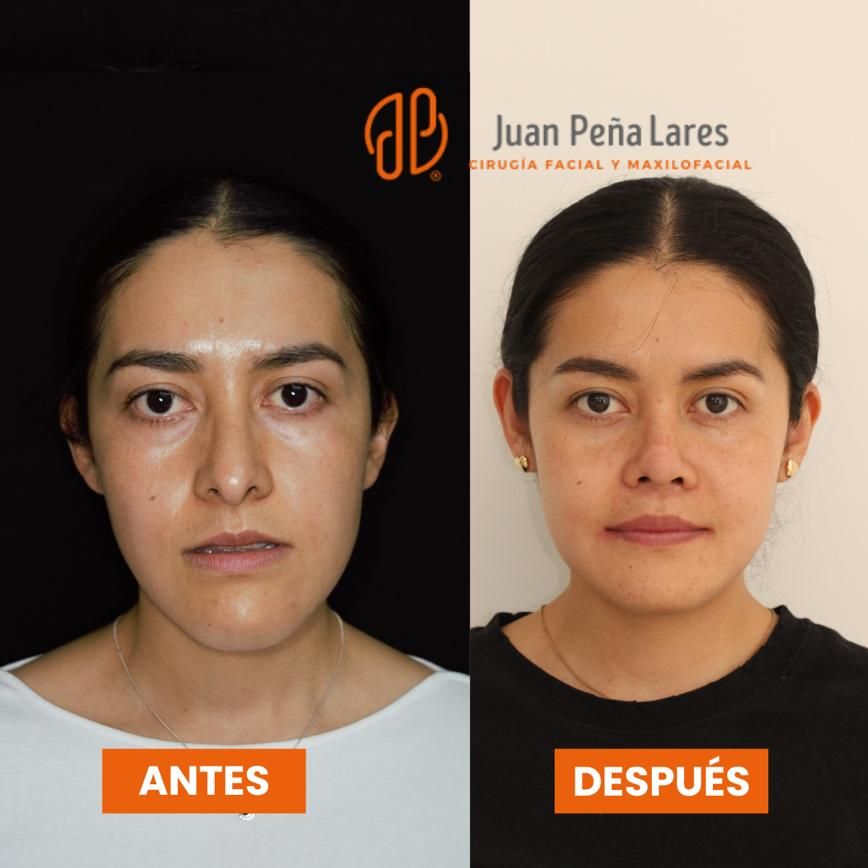 Juan Peña Lares-16