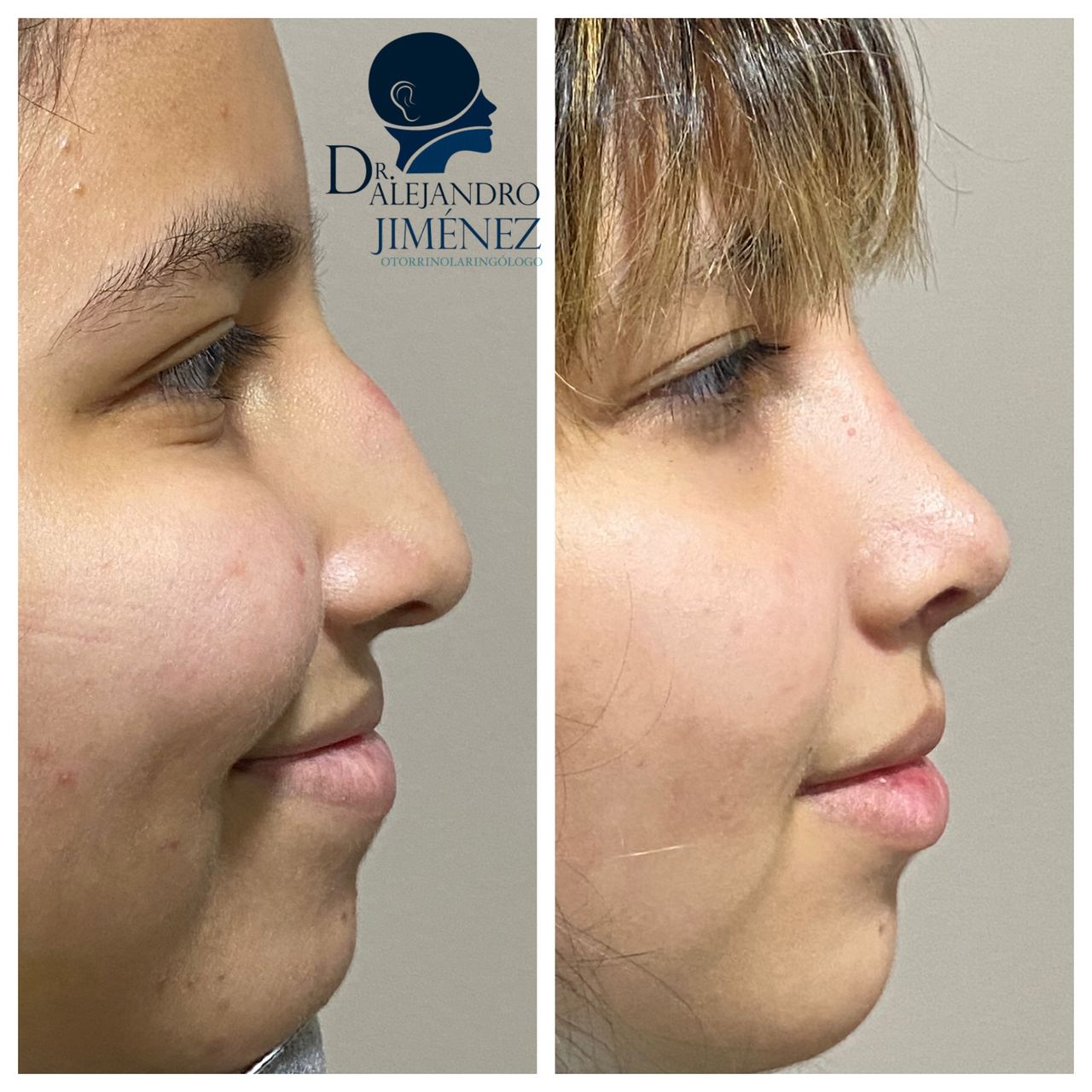 Alejandro Jimenez Garcia-21