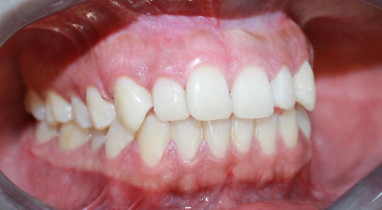 Jonathan Ortiz Zorraquin-13