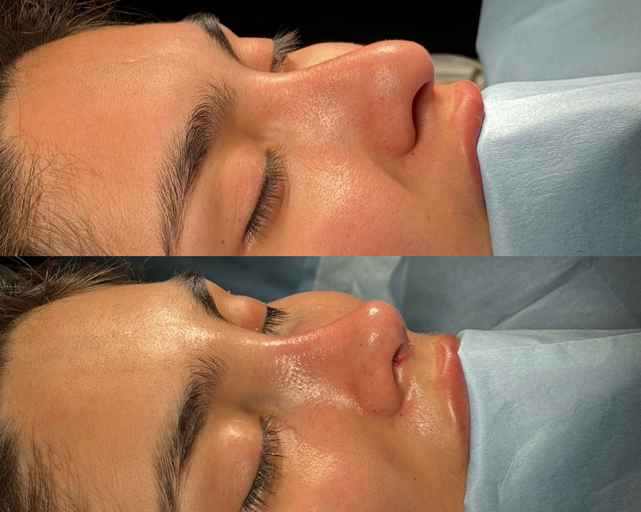 Angel Castro Urquizo-68