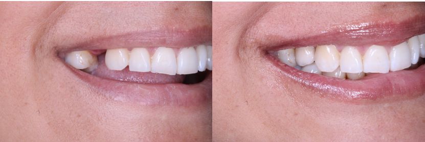 Ireri Rojas Bermúdez-8