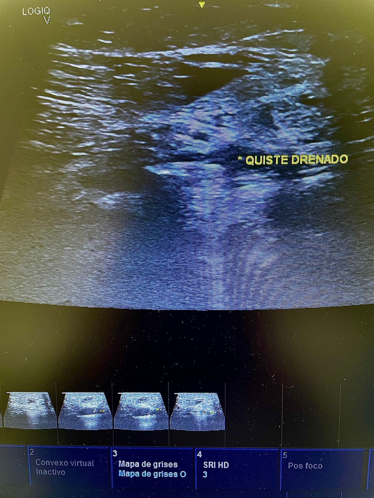 José Ismael Pineda Pérez-1