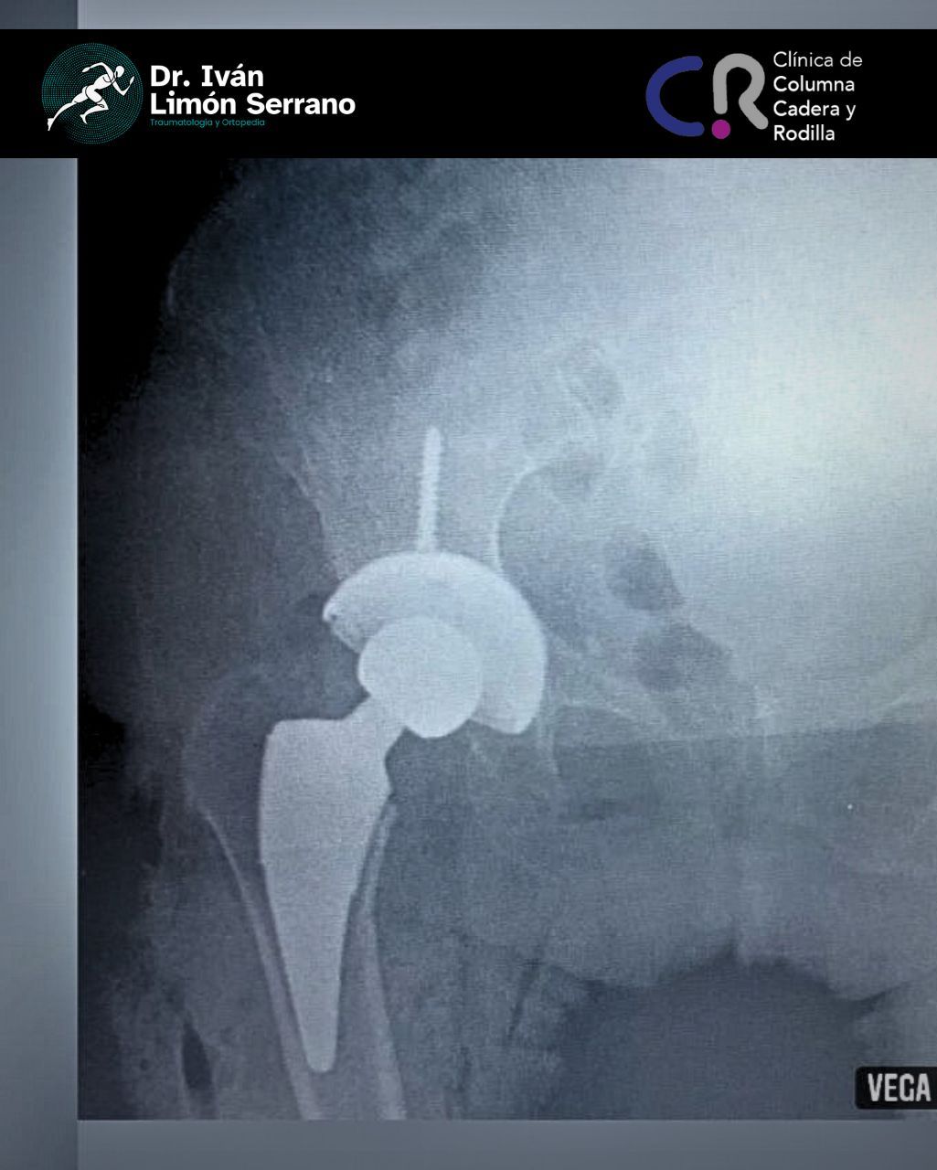 Iván Limón Serrano-43