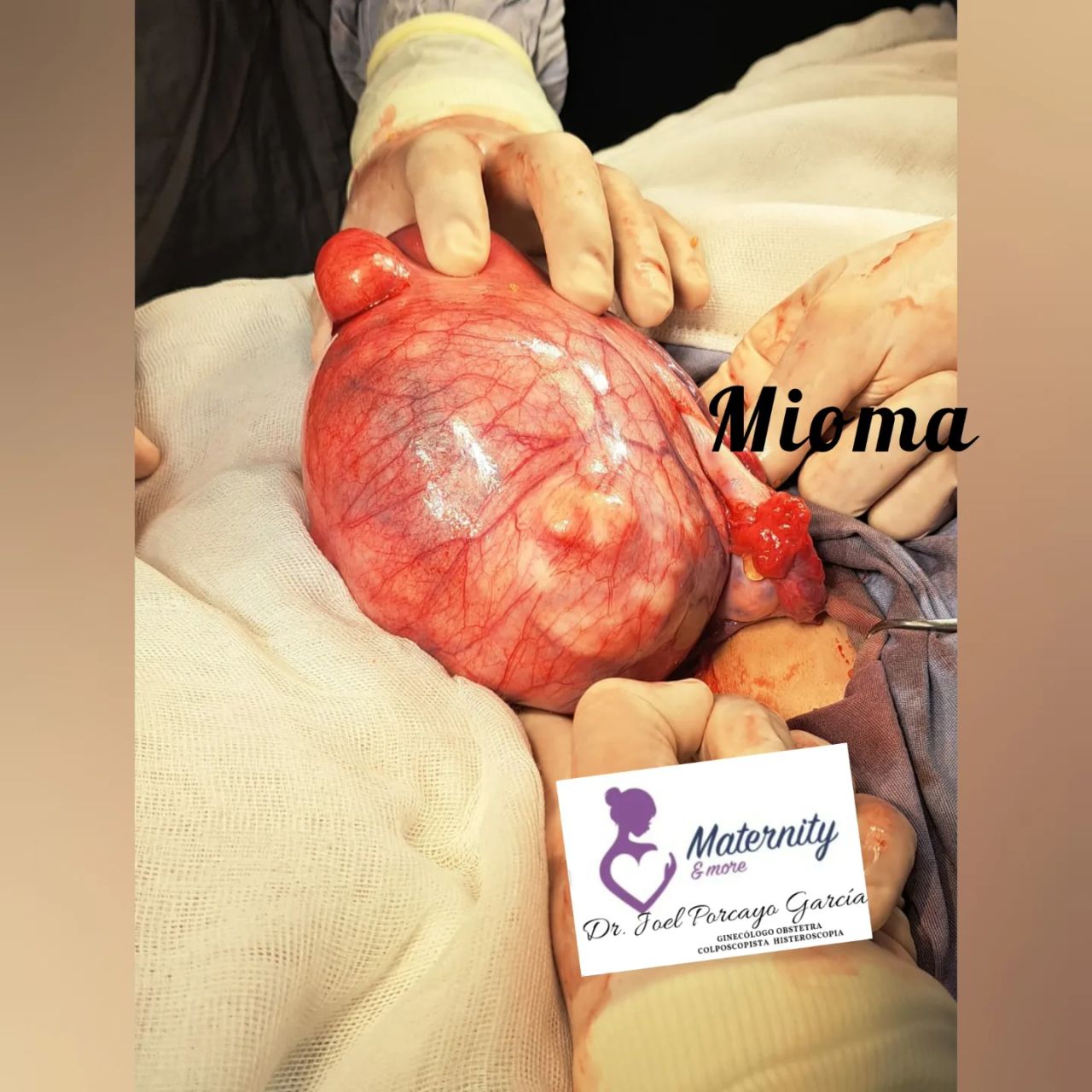 Joel Porcayo Garcia-8