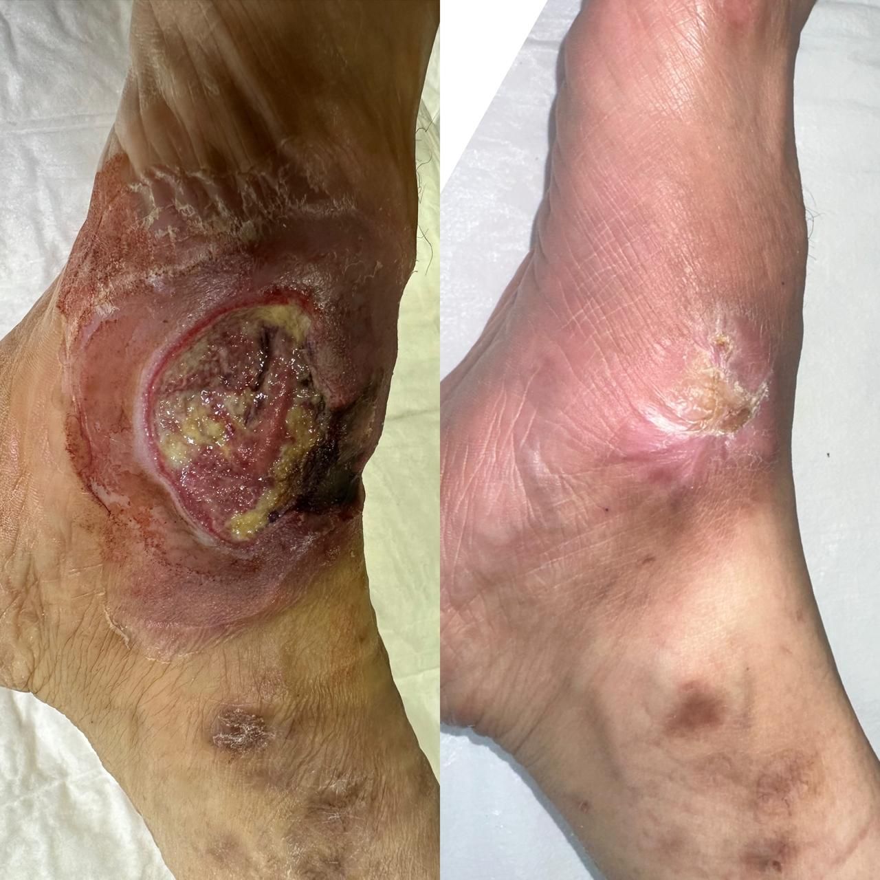 Jhonatan López González-55