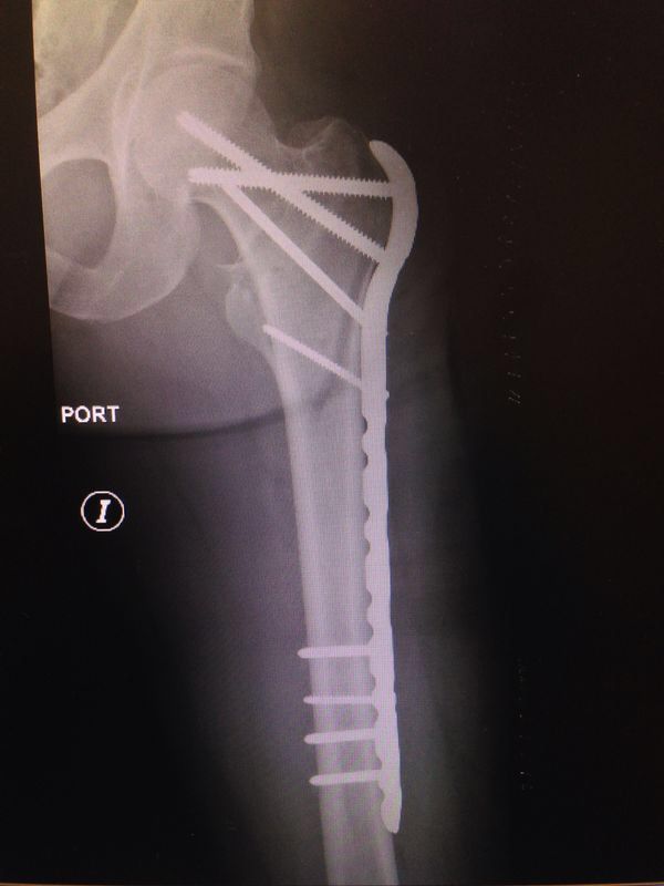 Marco Antonio Altamirano Cruz-6