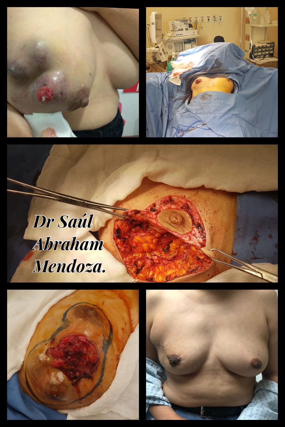 Saúl Abraham Mendoza-2