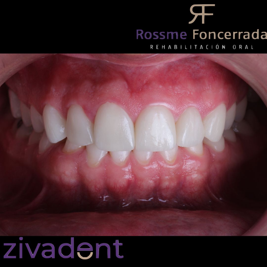 Rossme Foncerrada-4