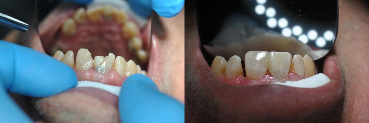 Joel Alejandro Sánchez Zúñiga-2