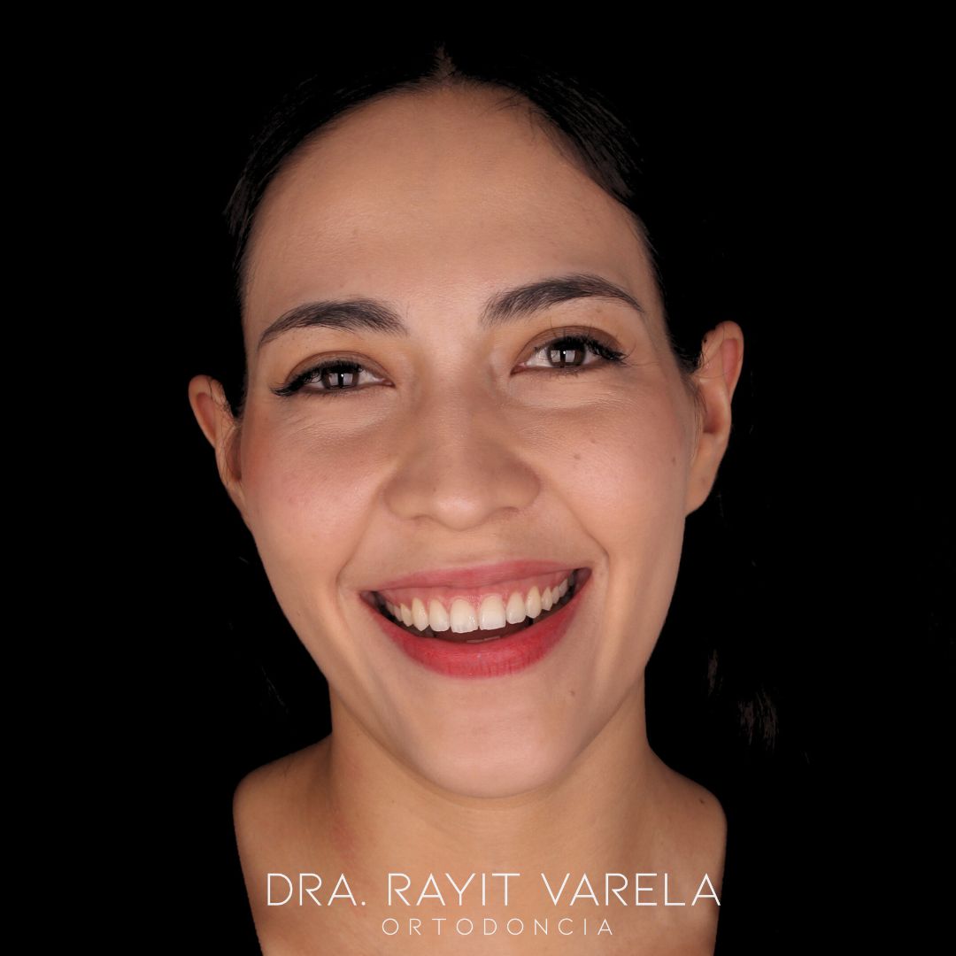 Rayit Varela-31