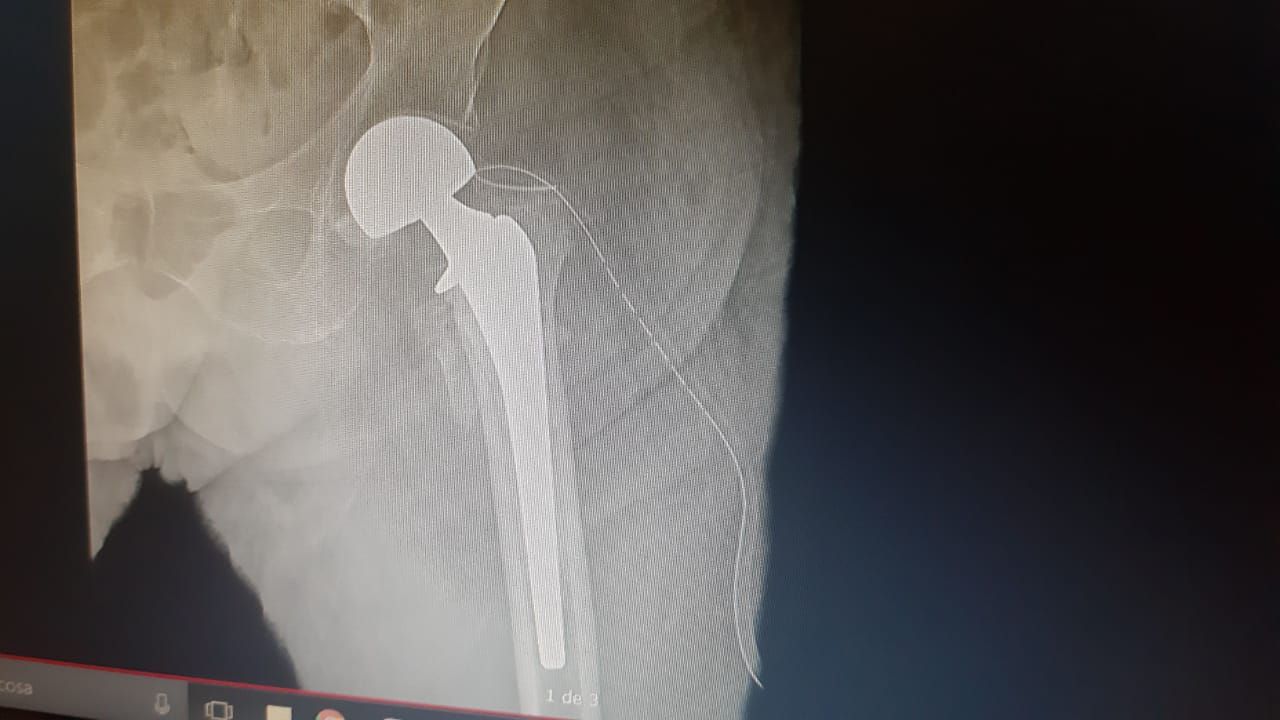 Julio Carlos Vélez De Lachica-21