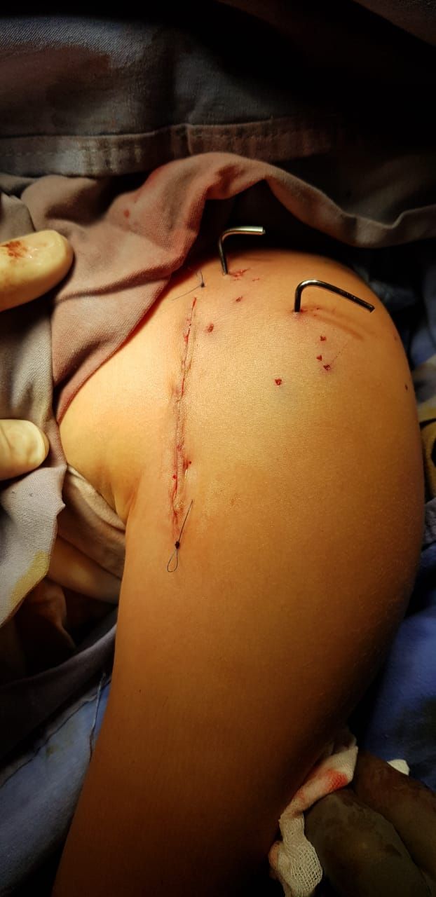 Alberto Viñas Silva-18