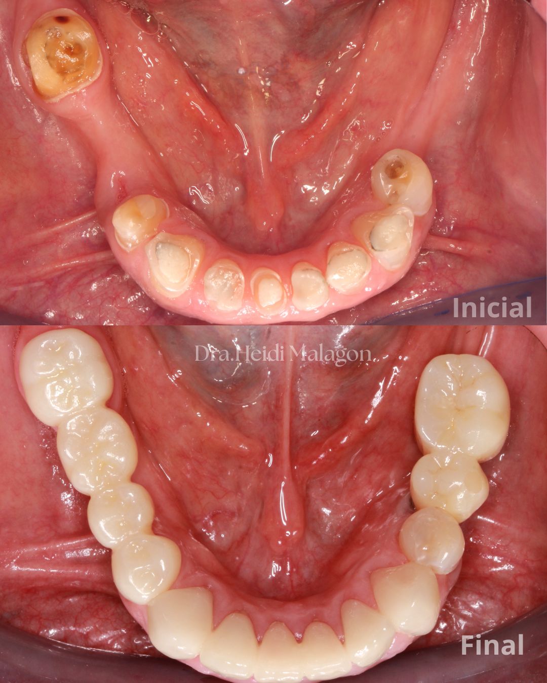 Heidi Mendoza Malagón-1