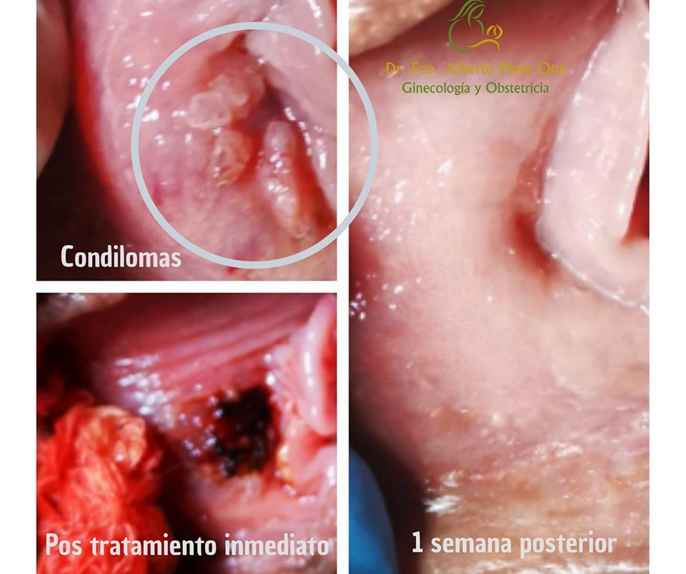 Francisco Alberto Perez Que-33