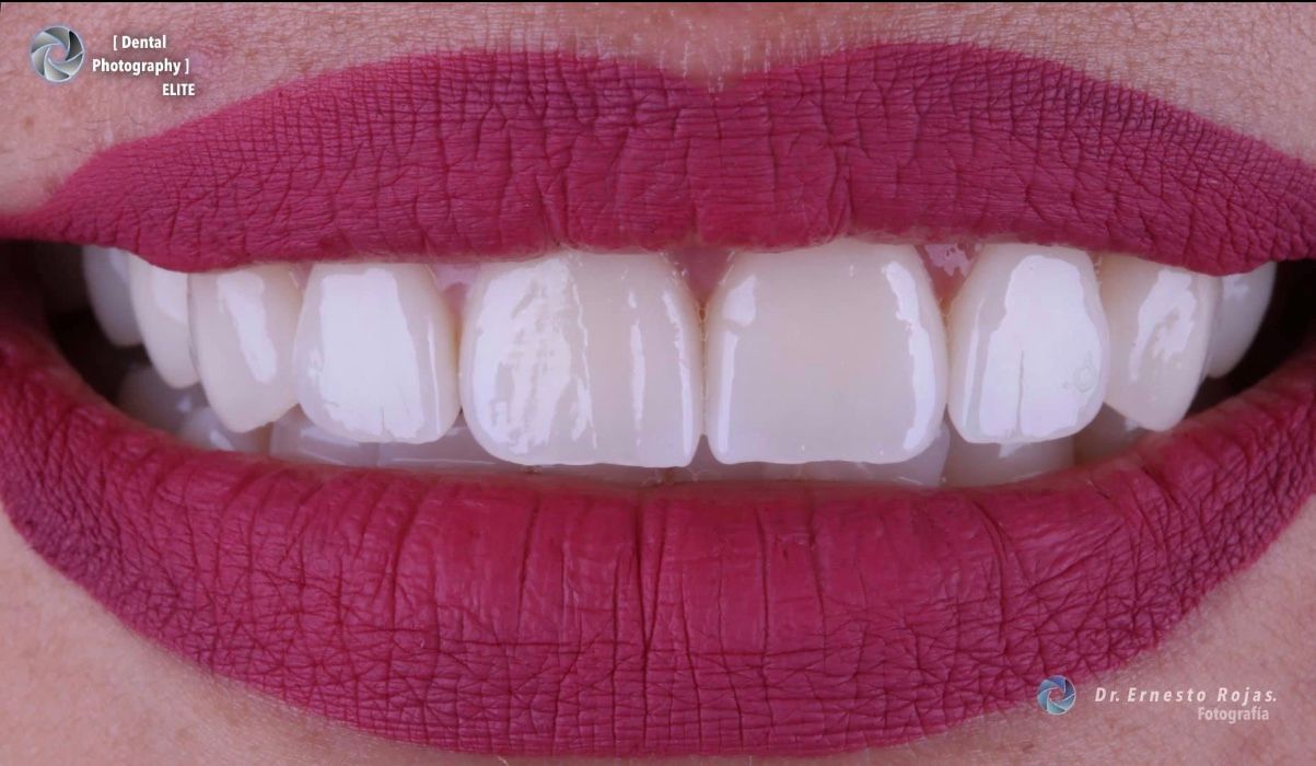 Ernesto Rojas Calderon-21