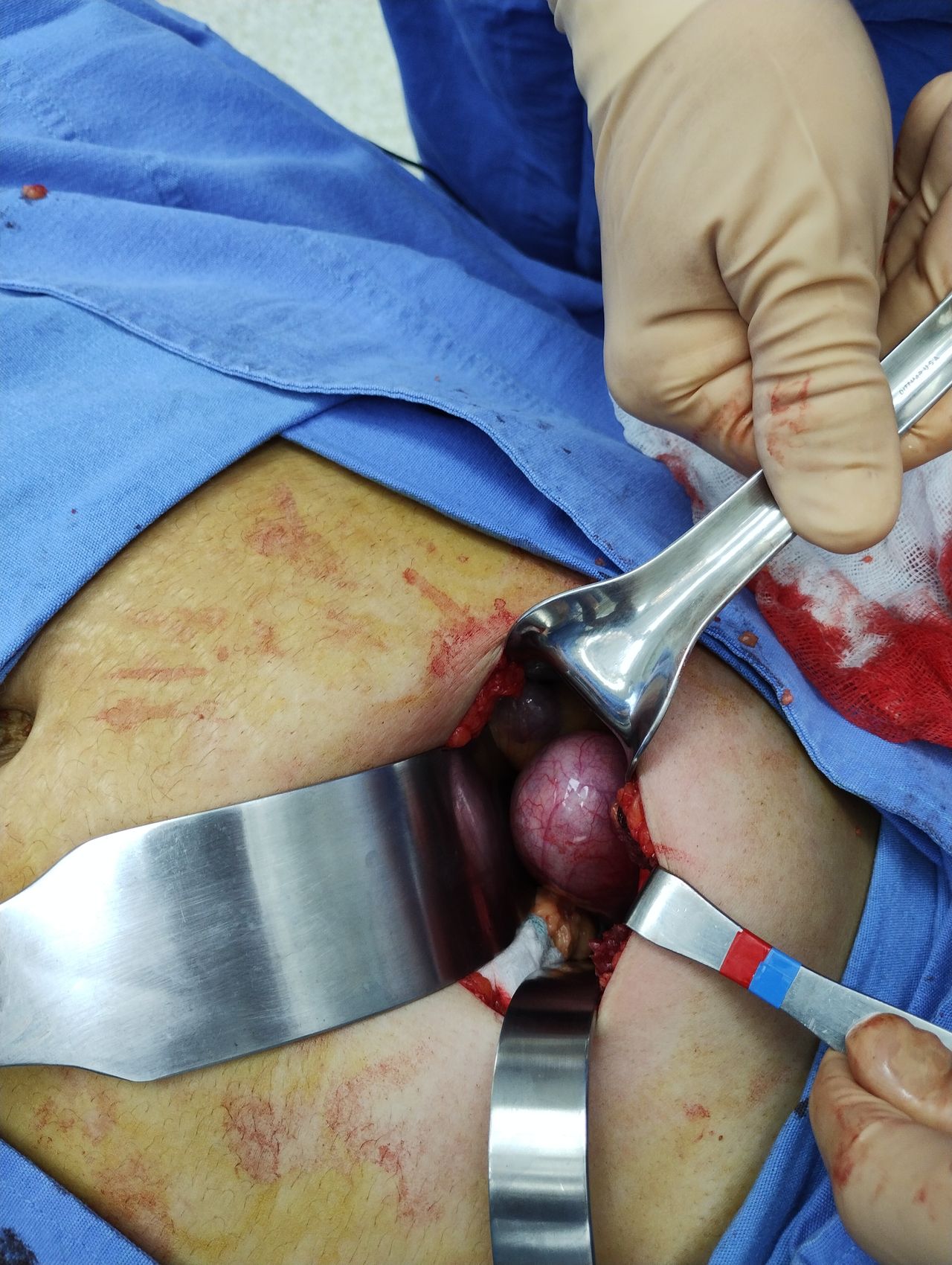 Jose Luis Banda Castillo-2