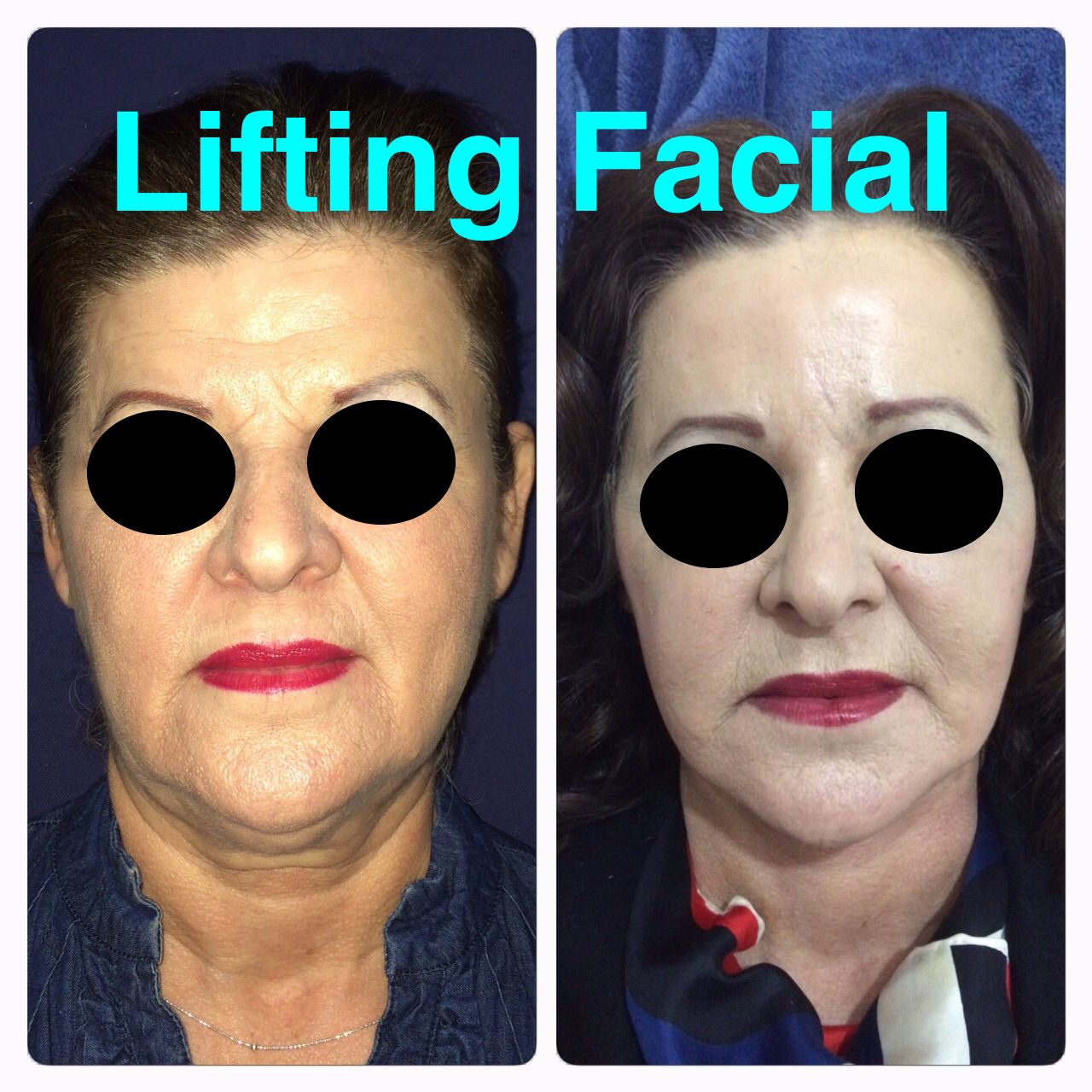 Ubaldo Carpinteyro Espín-5