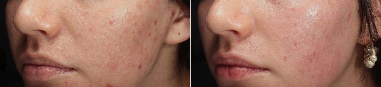 Lauro Francisco Varela Coronado-6