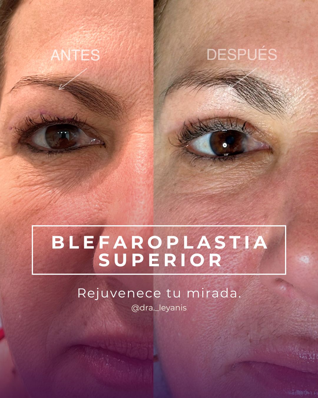 Leyanis Sánchez Hidalgo-10