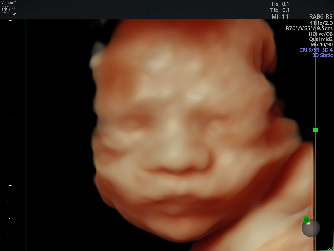 Martín Francisco Pérez Peña-4