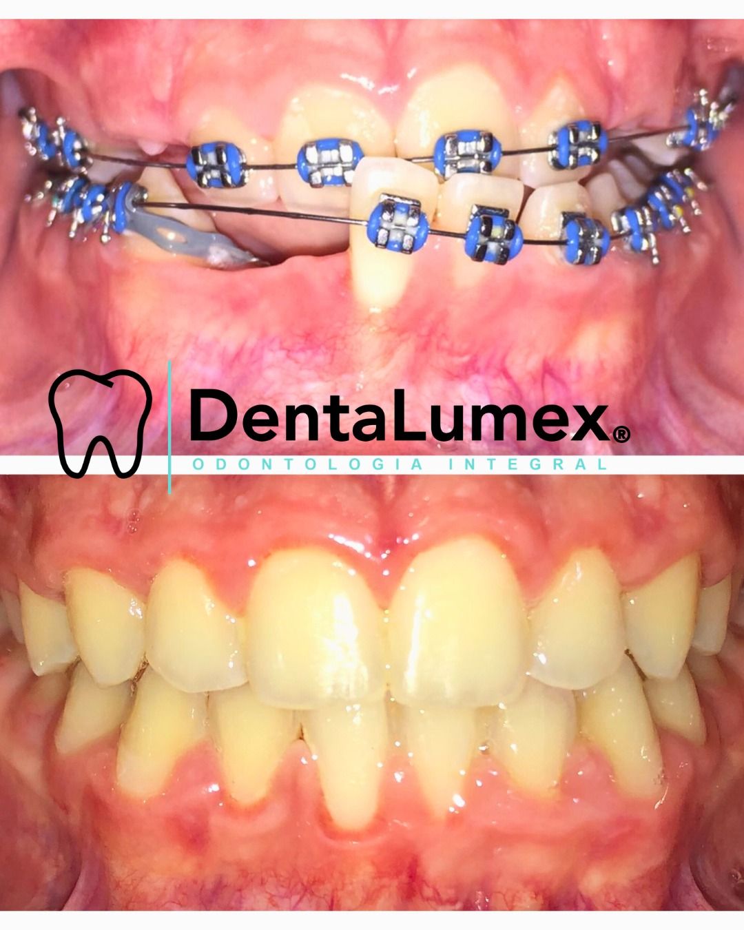 Nidya Irasema Gutierrez Garza-5