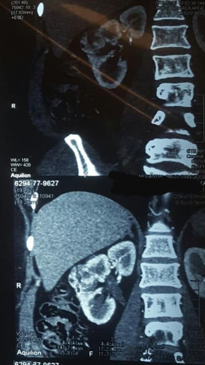 Pedro Enrique Martínez Constantino-20