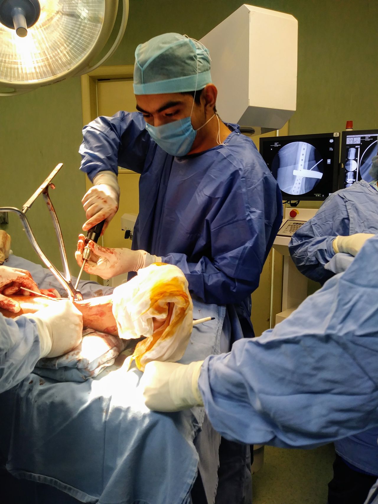 Max Adonay Chavez Alvarez-6