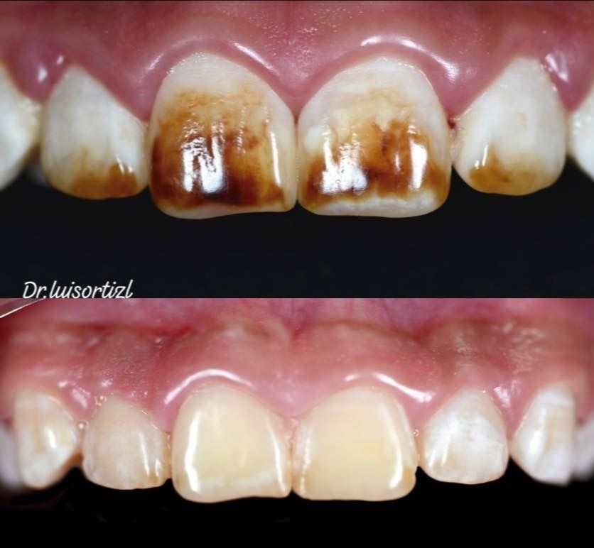 Luis Ángel Ortiz López-18