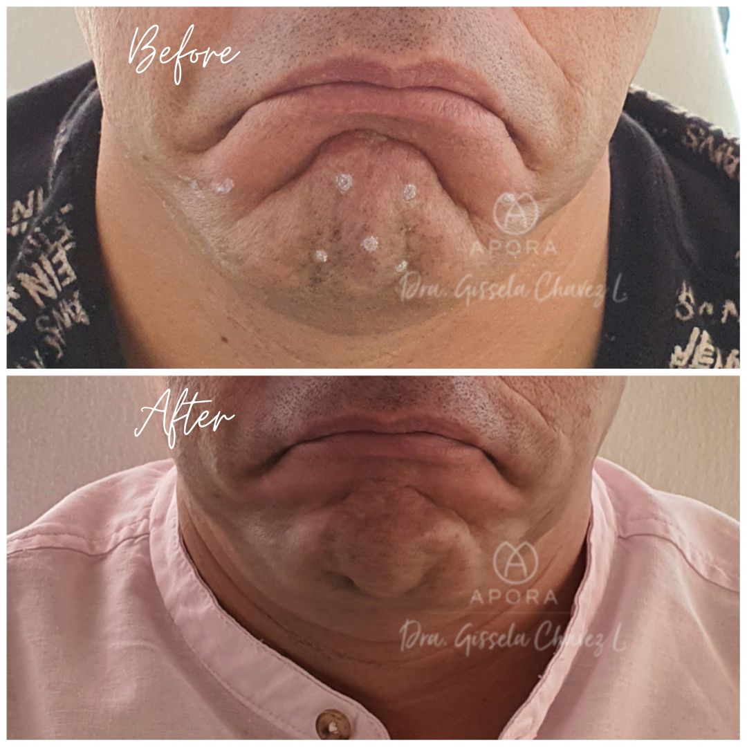 Gissela Chávez Lizardi-16