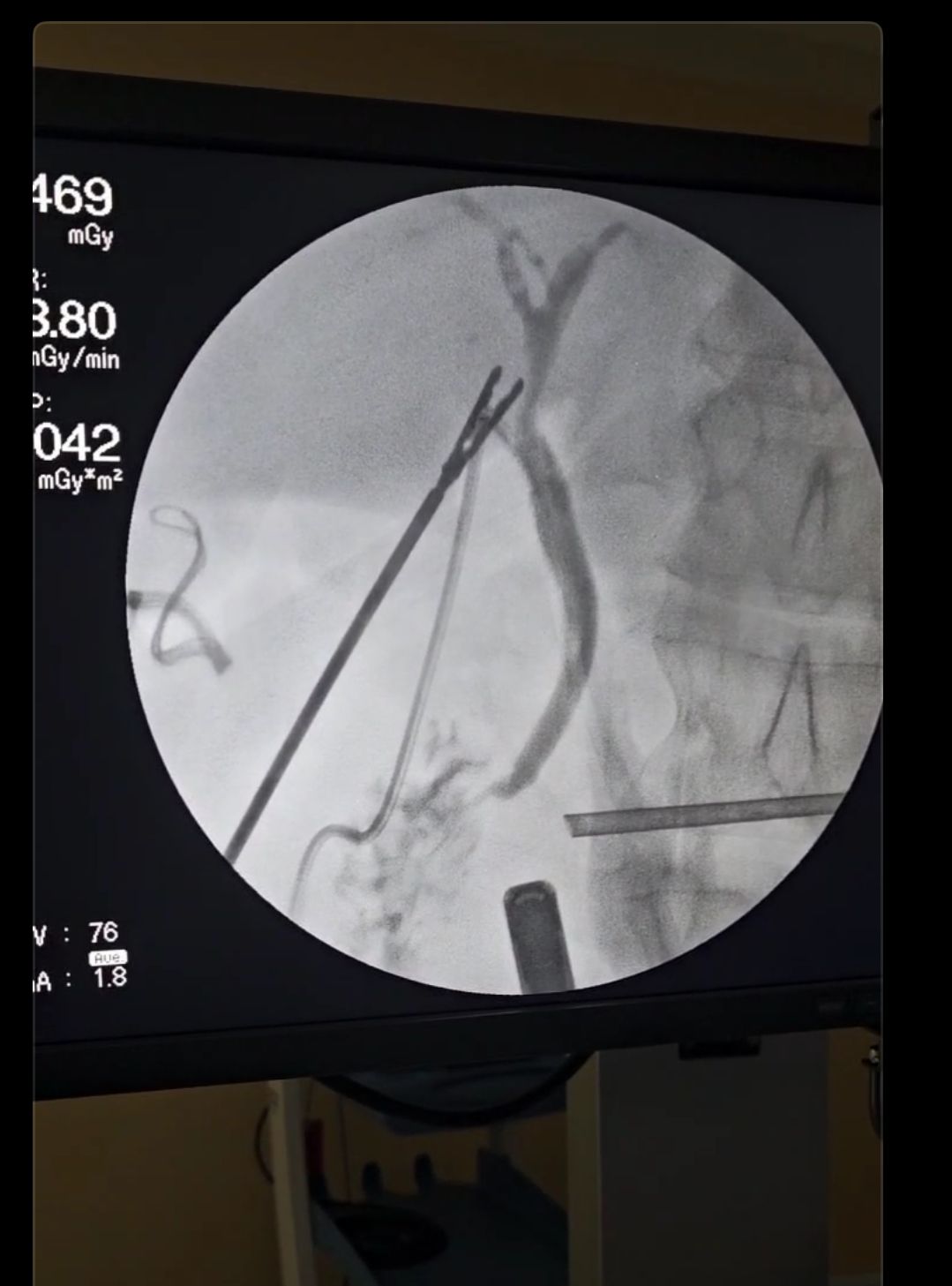 Ferstman Duran Hernandez-13