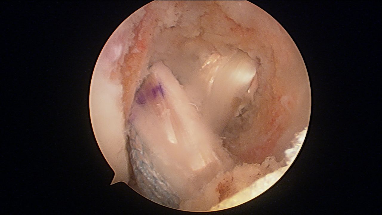 José Antonio Algarín Reyes-9