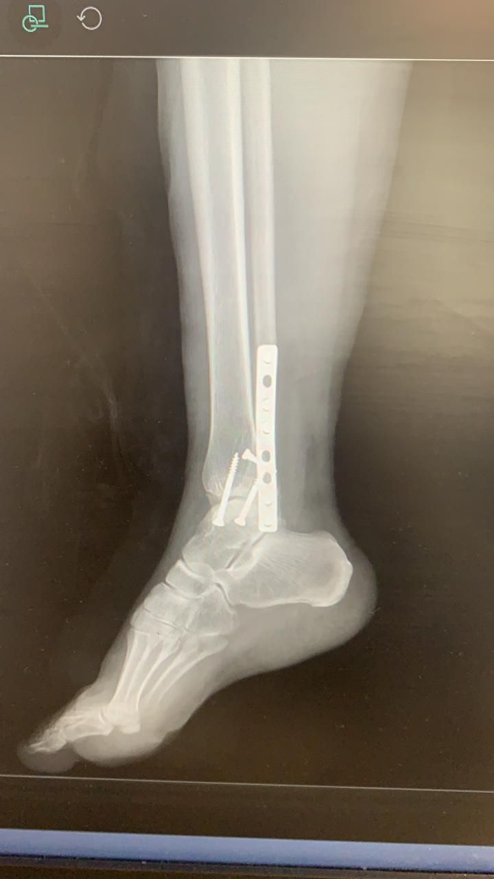 Jeftte Aaron Chacon Martinez-13