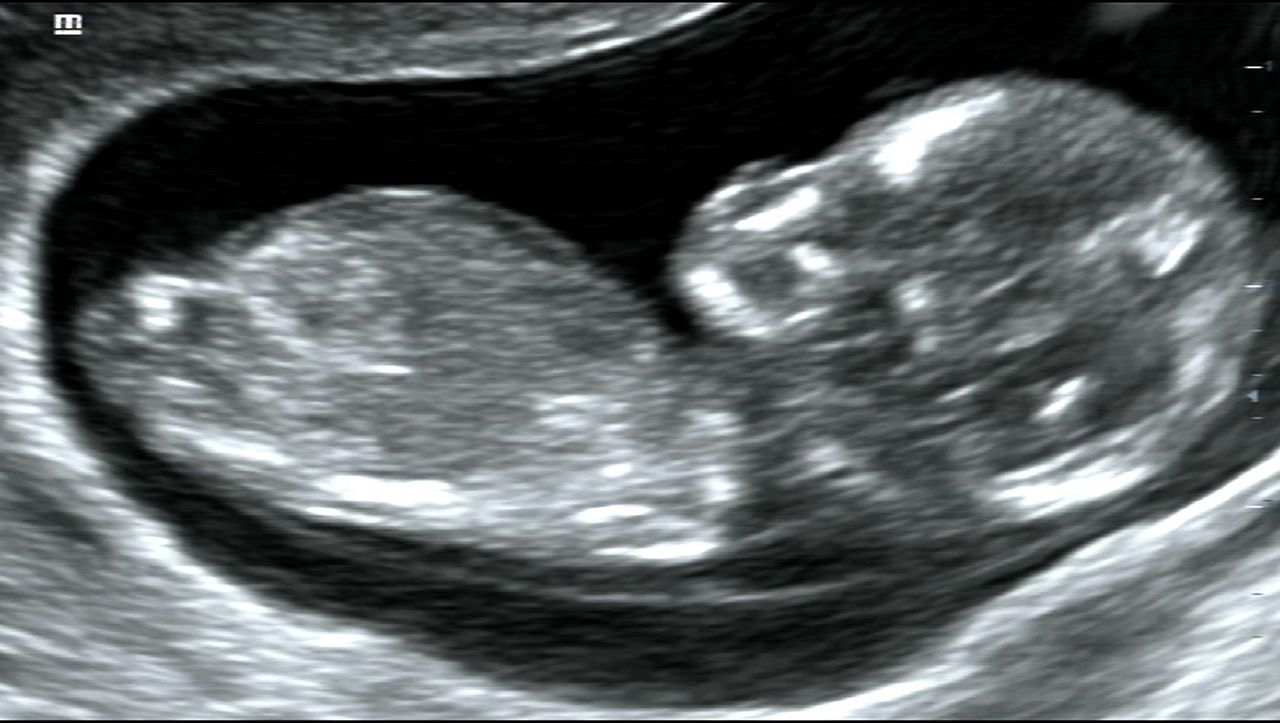 Mario López Franco-7