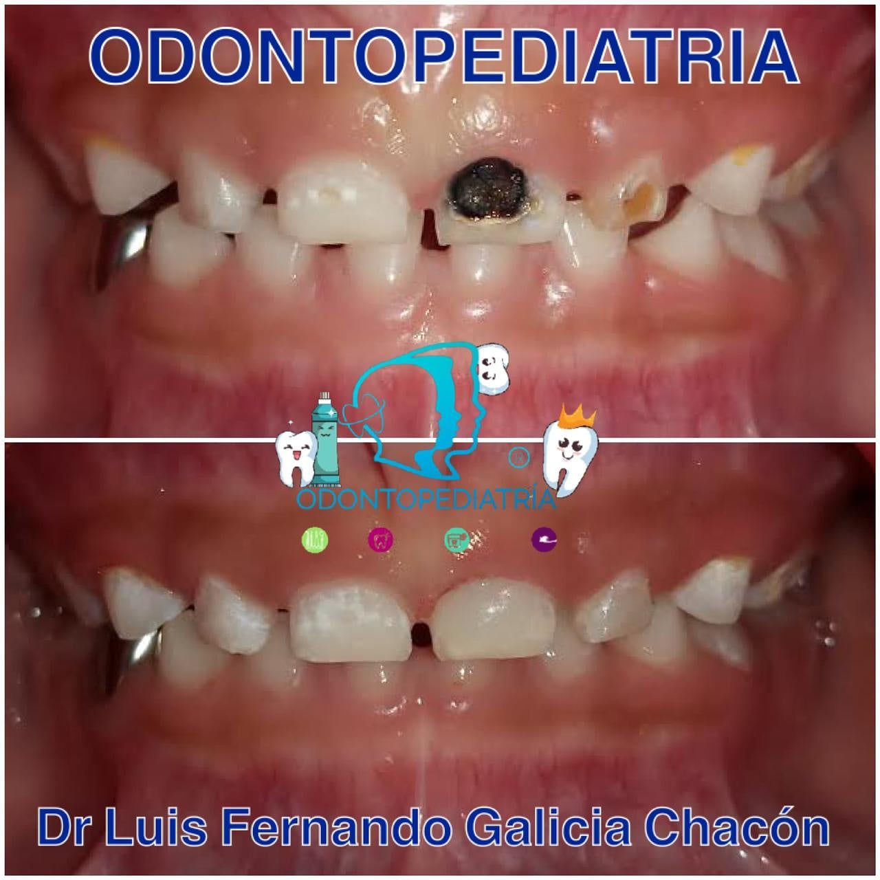 Luis Fernando Galicia Chacón-30