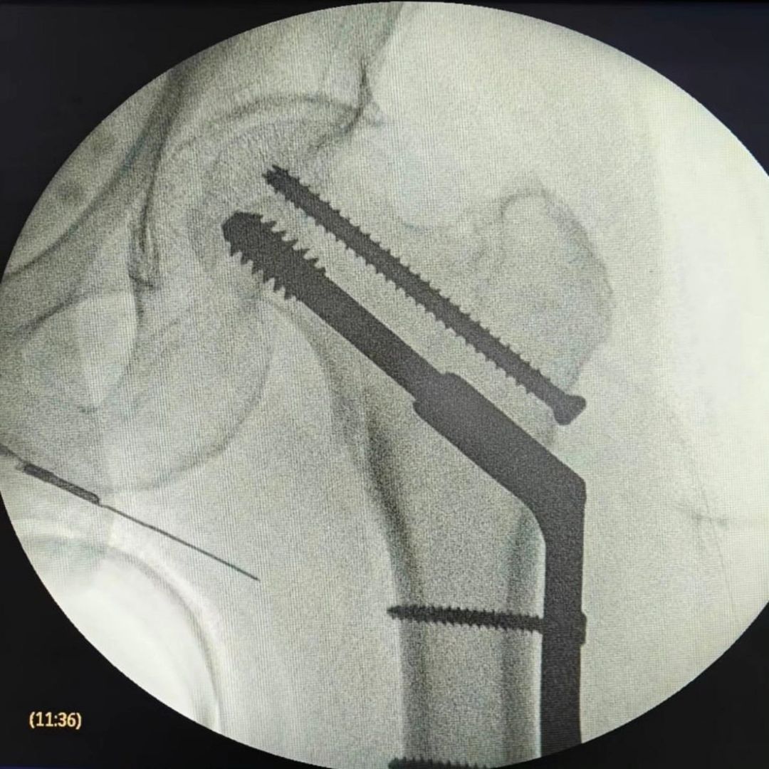 Amando Ramirez Zavala-5