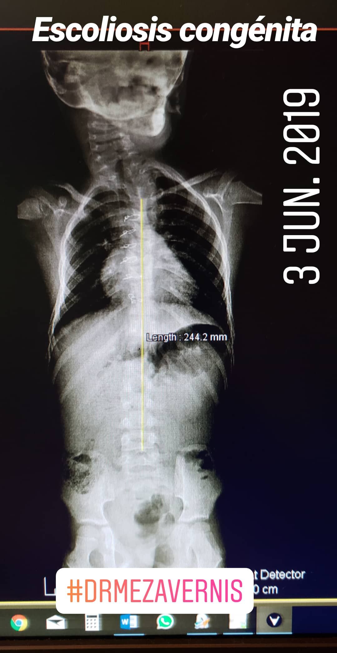 Alfonso Meza Vernis-73