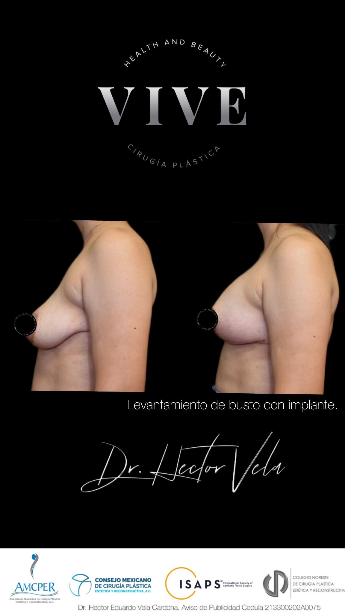 Héctor Eduardo Vela Cardona-37