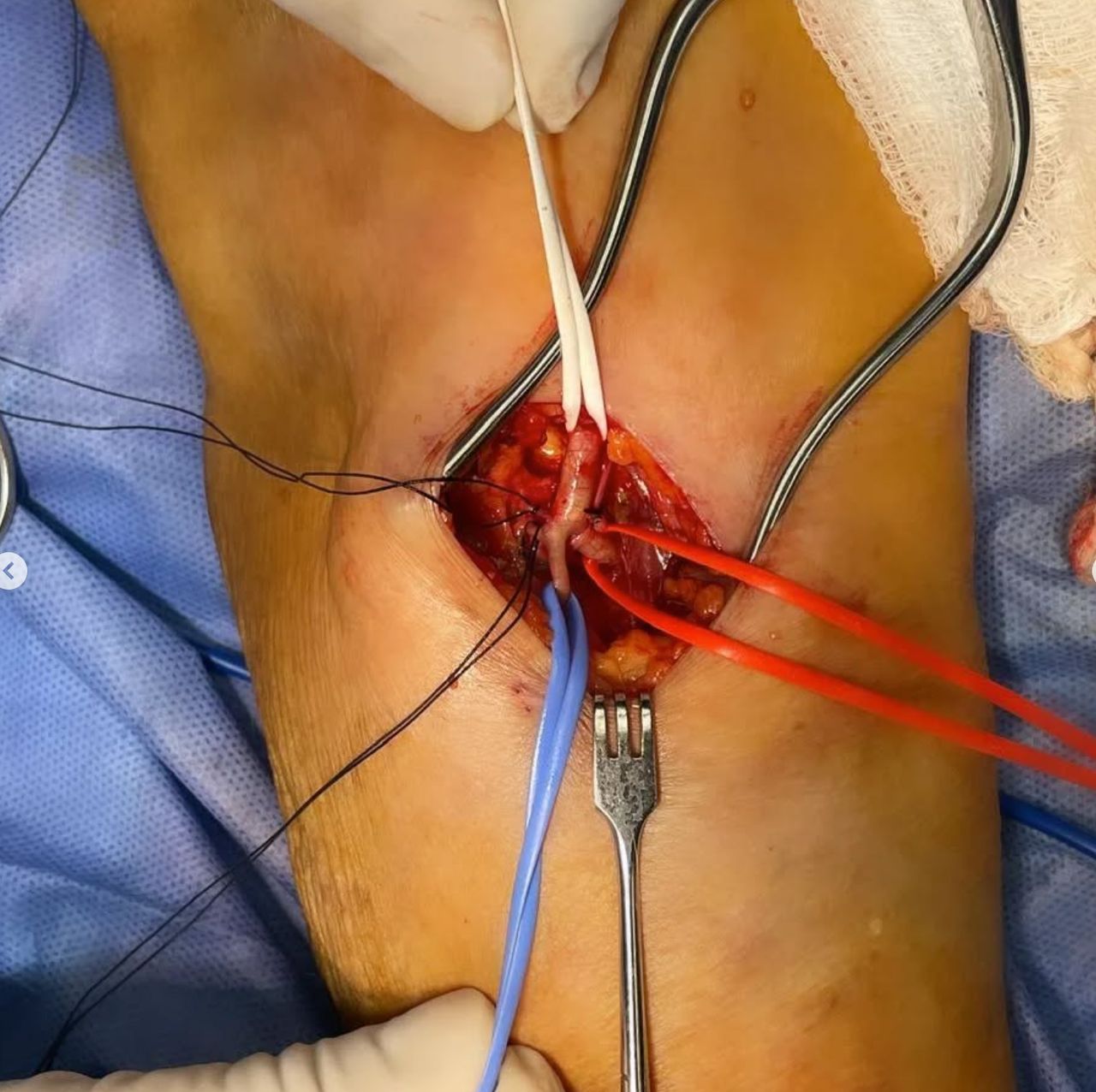 Hugo Alberto Escalante Escobedo-15