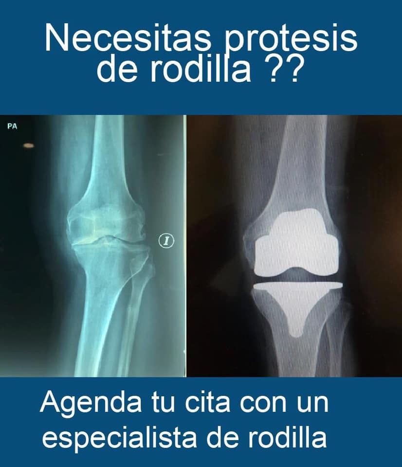 Cristopher Jonathan Montalvo Díaz-7