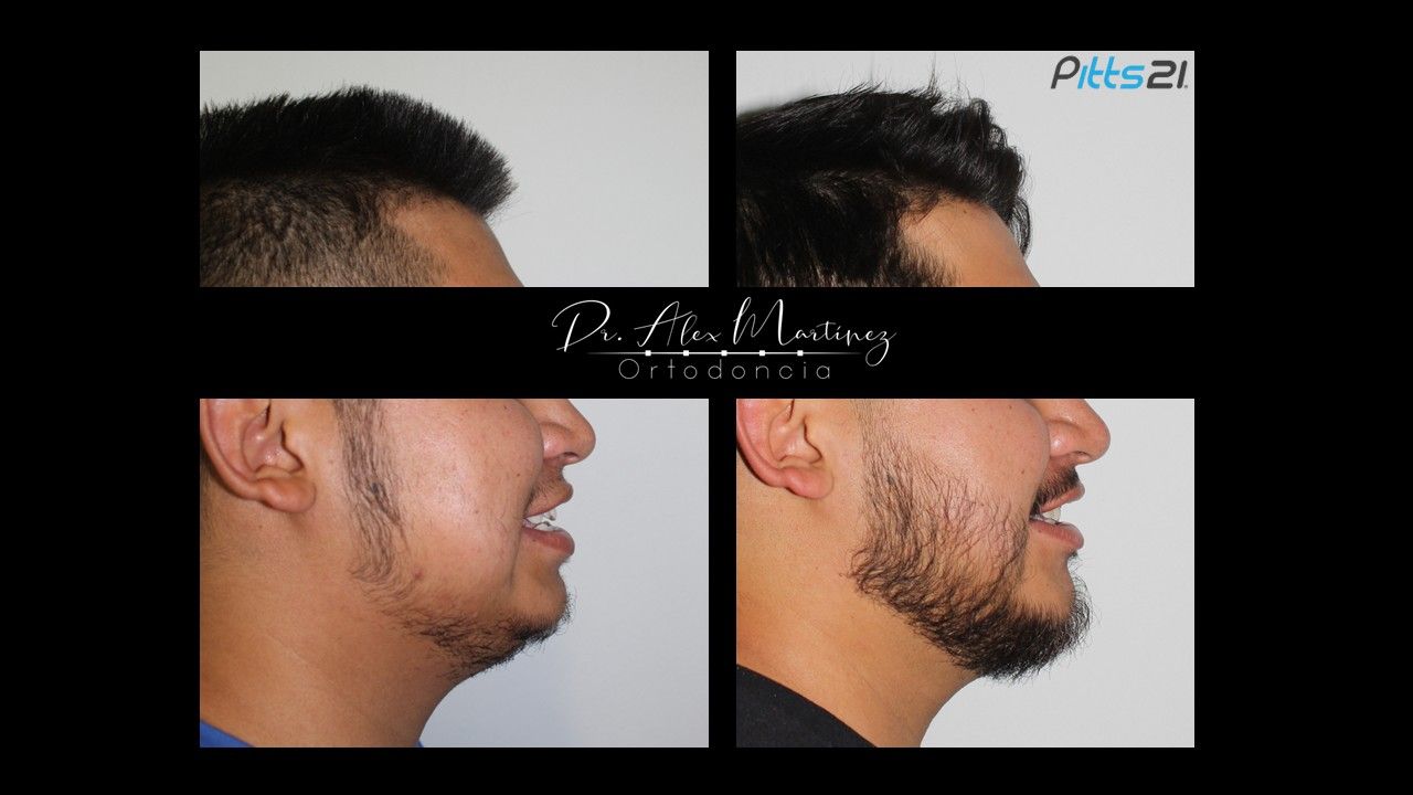 Alejandro Martínez Hernández-17