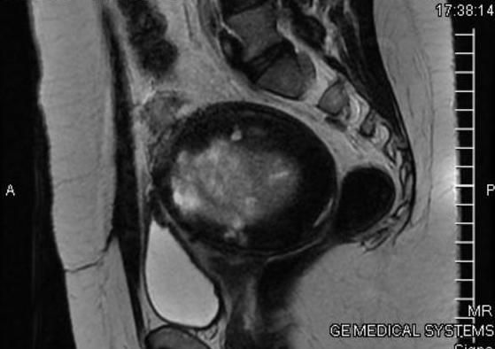 Germán Gabriel Palacios López-3