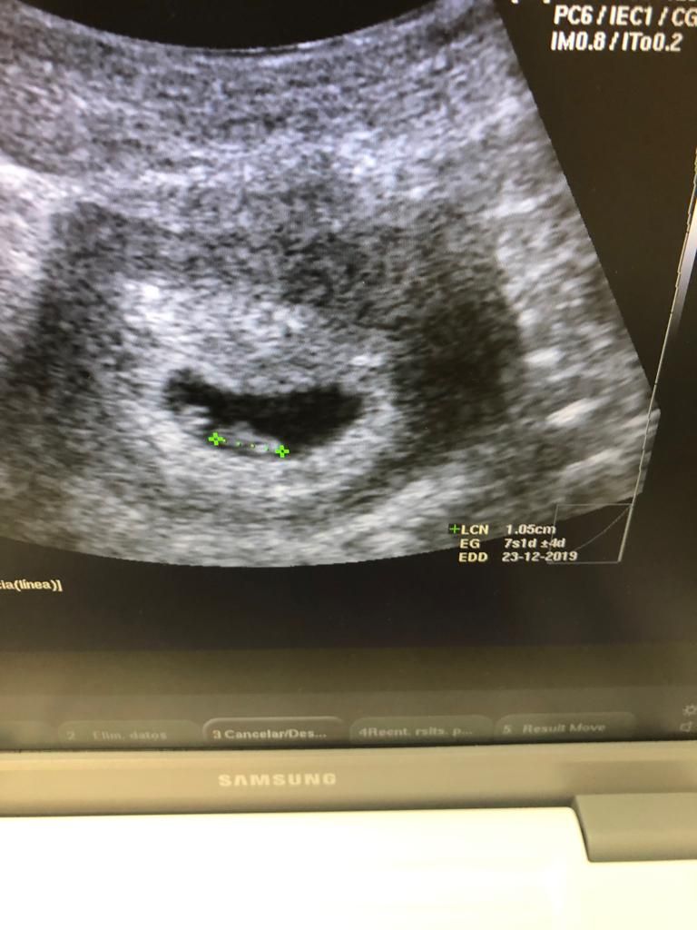 Imelda Zárate Fierro-8