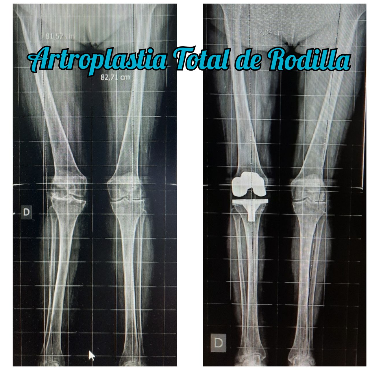 Otilia Gallegos De La Torre-2