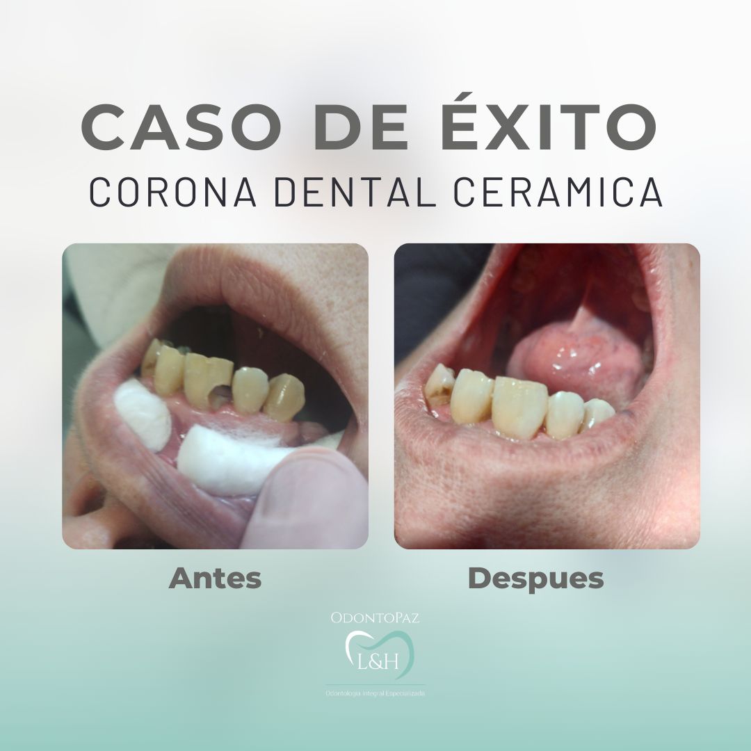 Enrique López Limón-3