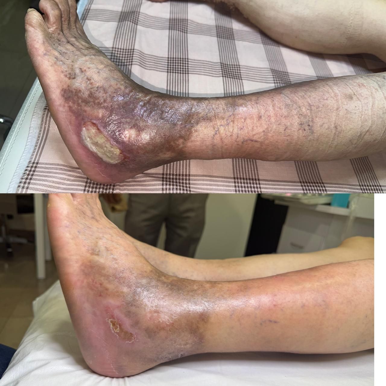 Jhonatan López González-22