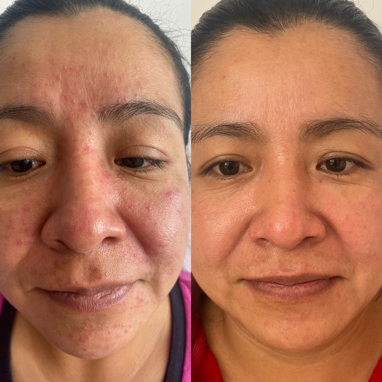 Venecia Landini Enríquez-2