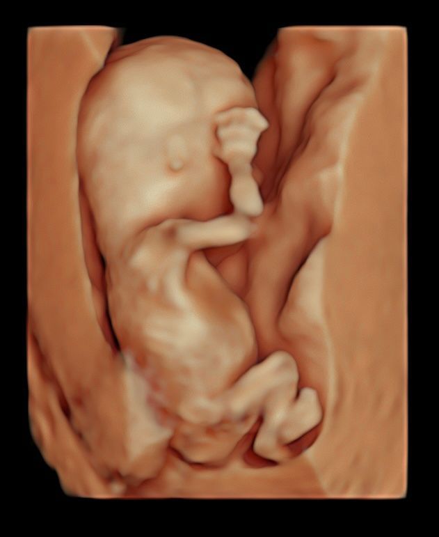 Héctor Alexandro Moreno Plata-4