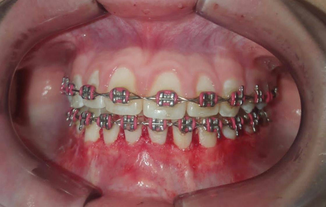 Alejandro Alcocer Flores-18